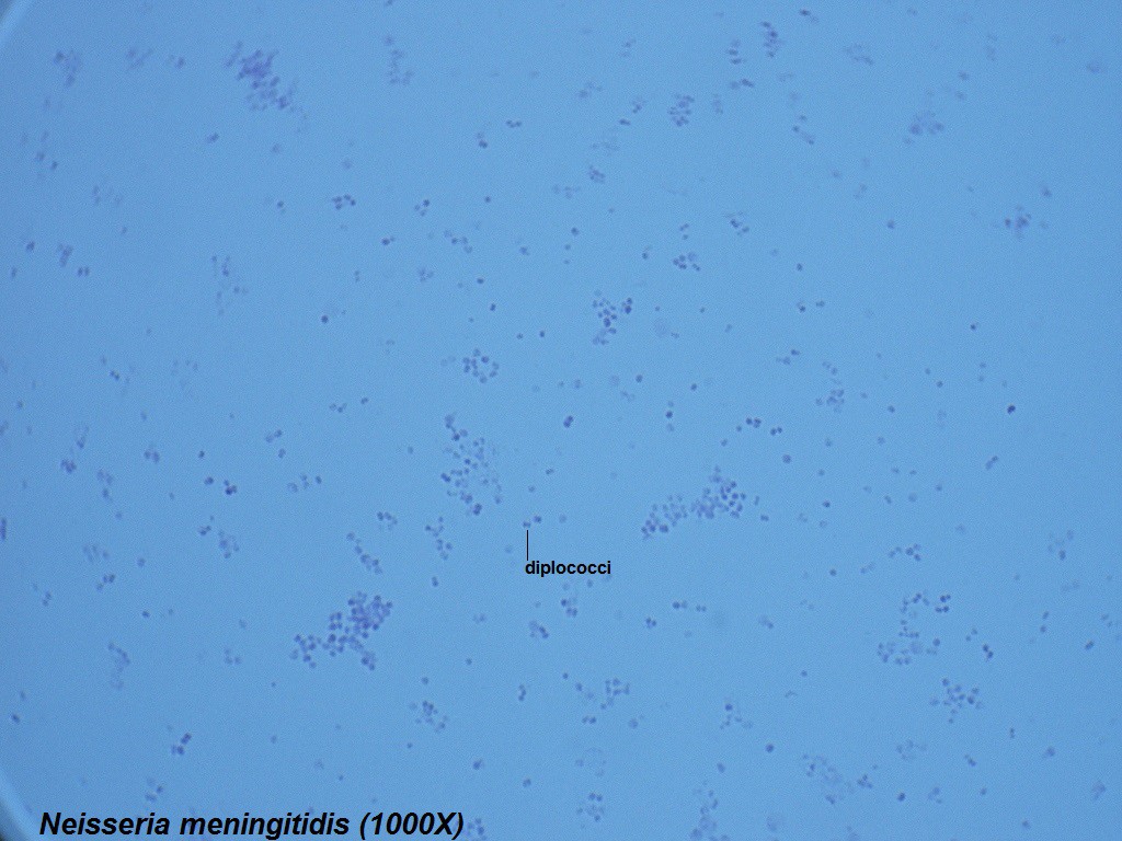 N - Neisseria meningitidis 1000X - 1