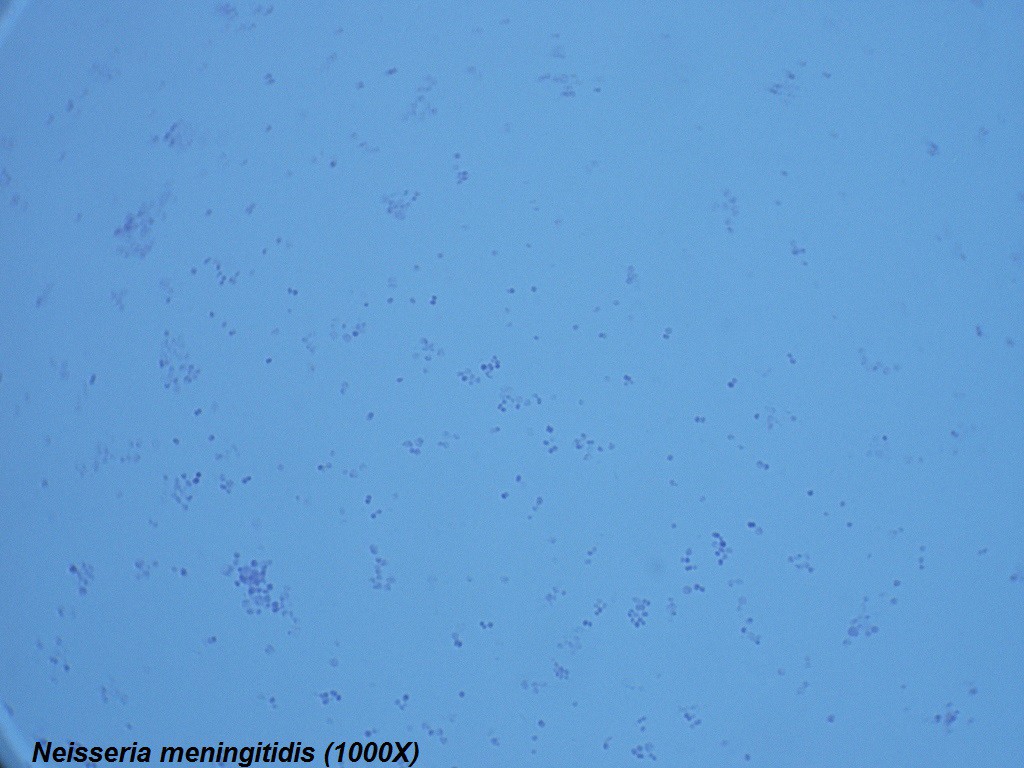 O - Neisseria meningitidis 1000X - 2