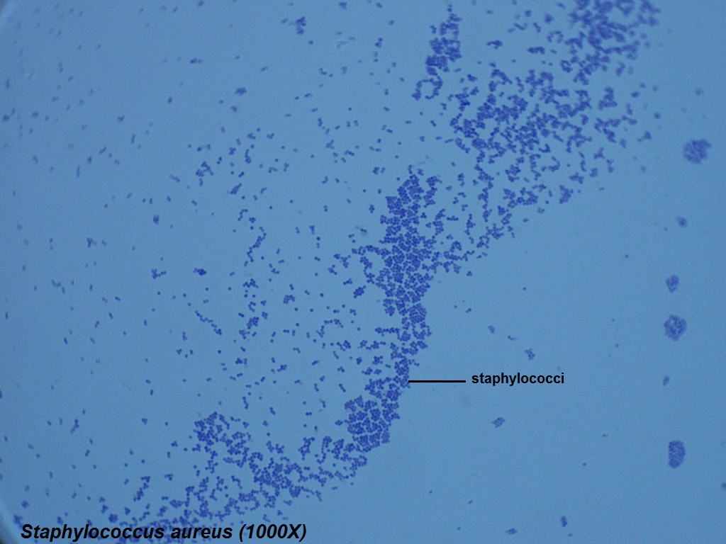 P - Staphylococcus aureus 1000X - 1