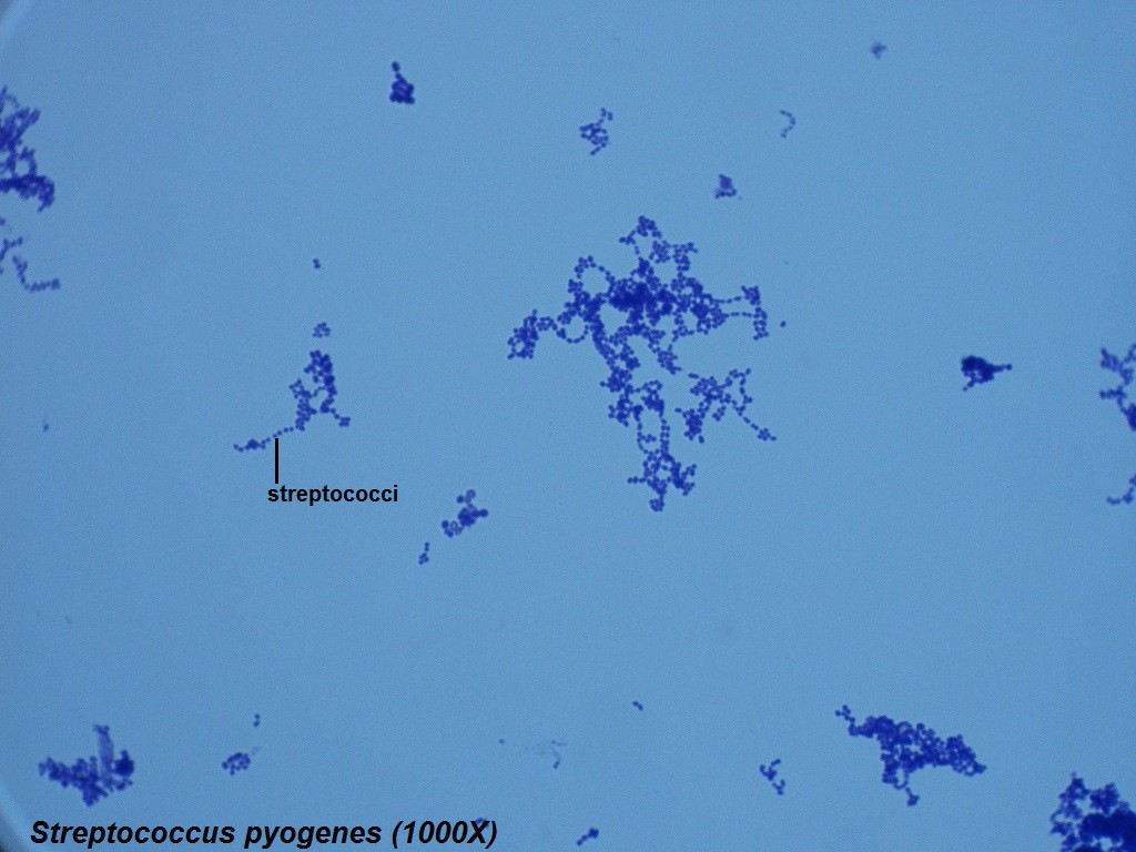 R - Streptococcus pyogenes 1000X - 1