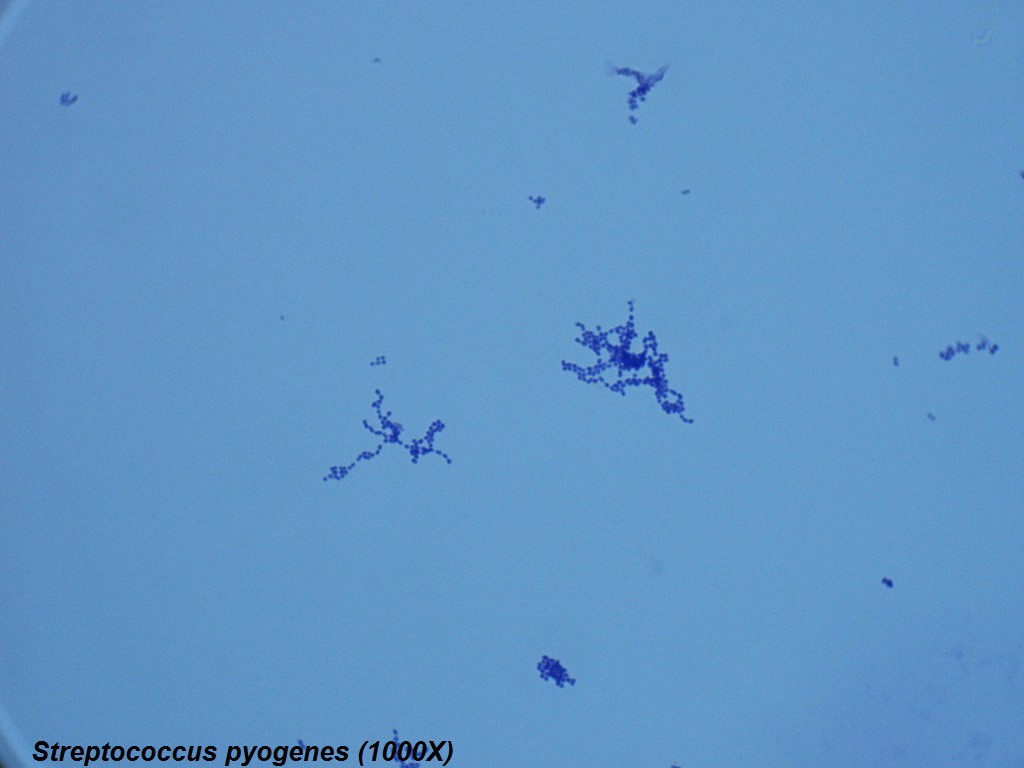 S - Streptococcus pyogenes 1000X - 2