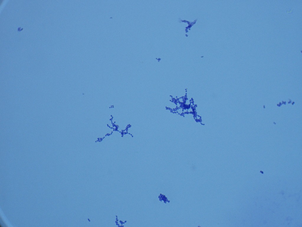 Streptococcus pyogenes 1000X - R