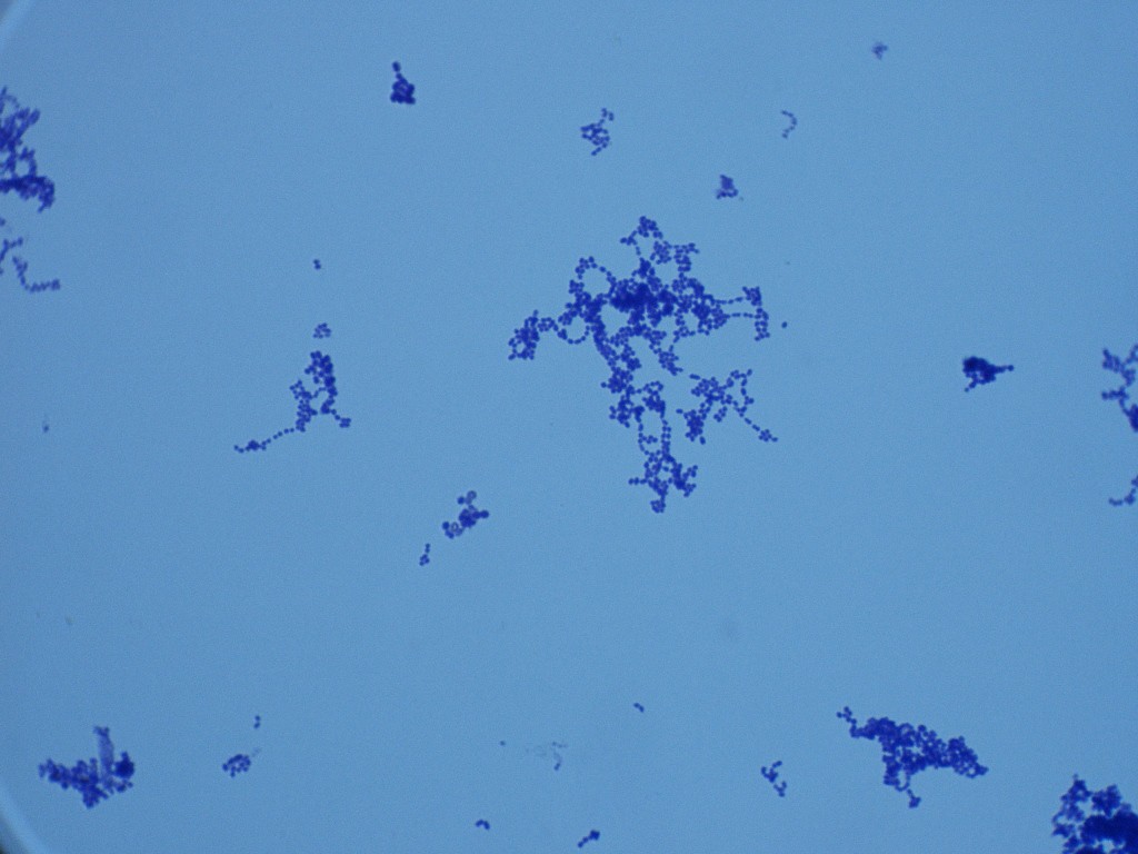 Streptococcus pyogenes 1000X - S