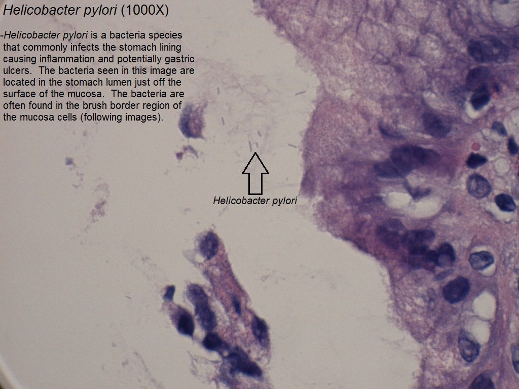 A - Helicobacter pylori - Gastric Mucosa - 1000X