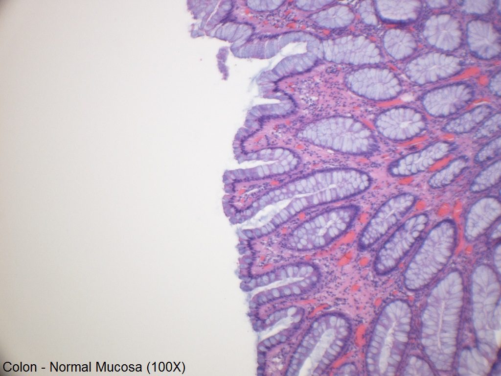 A - Normal Colon Mucosa - 100X