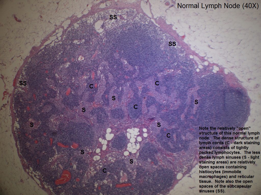 A Normal Lymph Node 40X