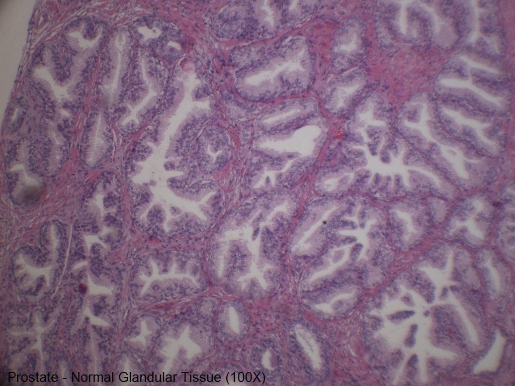 A - Normal Prostate - 100X
