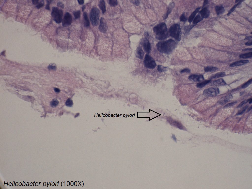 B - Helicobacter pylori - Gastric Mucosa - 1000X