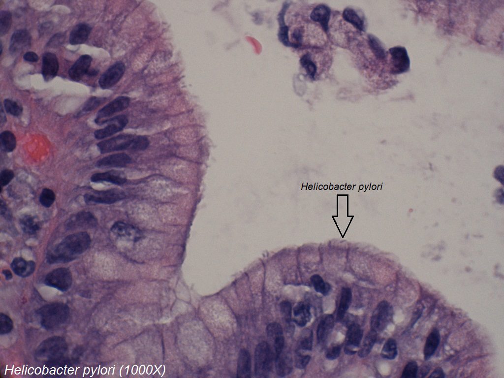 C - Helicobacter pylori - Gastric Mucosa - 1000X