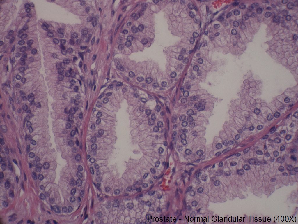 C - Normal Prostate - 400X