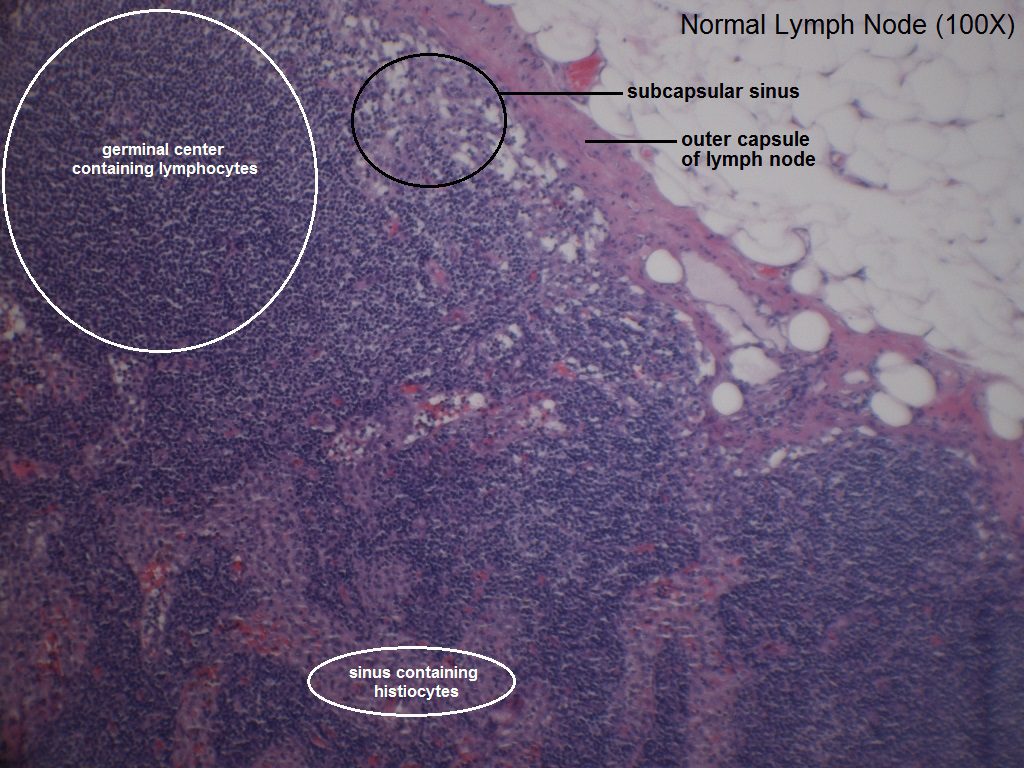 D - Normal Lymph Node - 100X