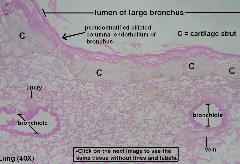 A – Bronchus and Bronchiole 40X 1
