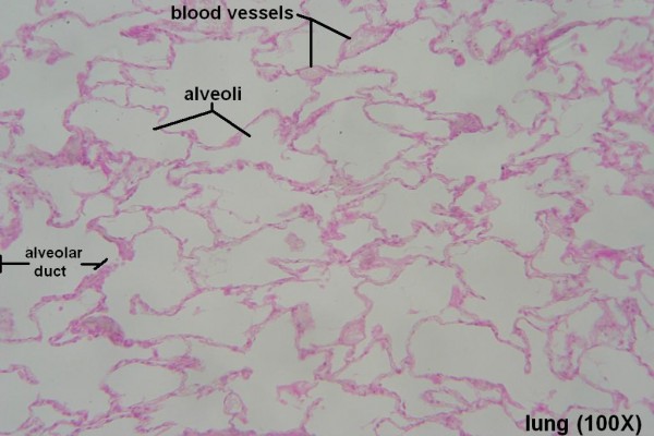 A – Lung Alveoli 100X 1