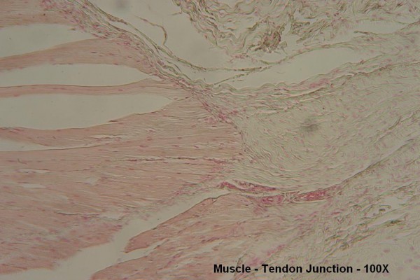 A – Muscle – Tendon Junction 100X 1