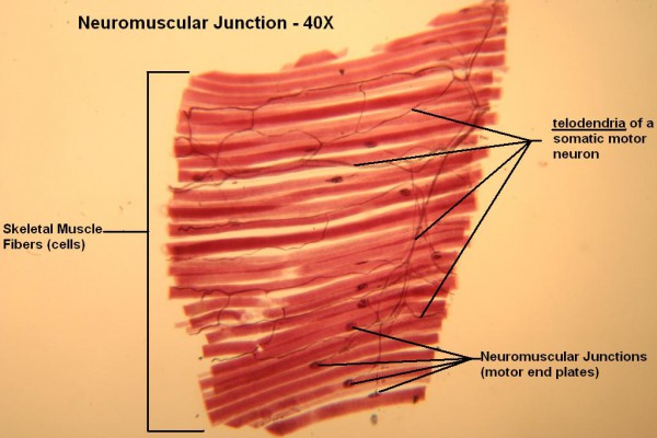 A – Neuromuscular Junction 40X 1
