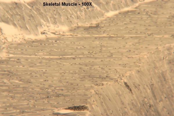 A Skeletal Muscle 100x 1