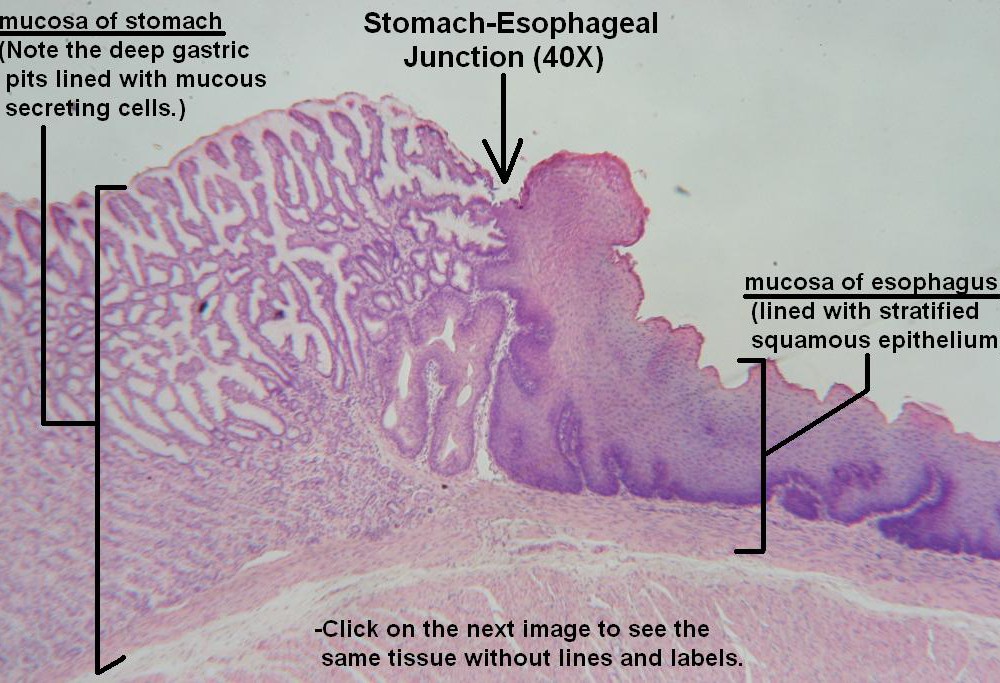 A Stomach Esophagus Jxn 40X 1