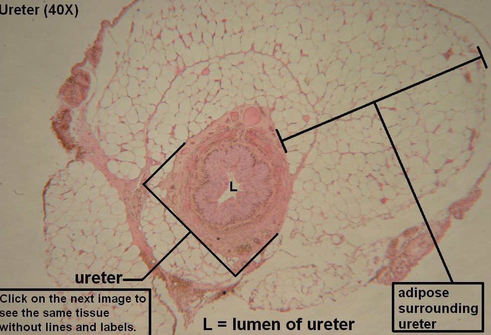 A – Ureter 40X 1