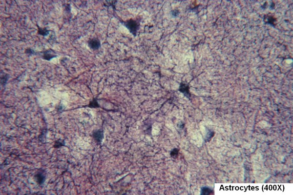 Astrocytes 400X 1