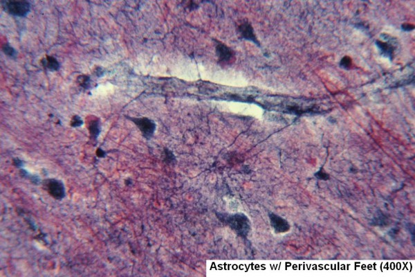 Astrocytes with Perivascular Feet 1