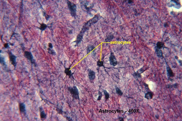 B – Astrocytes 400X 2