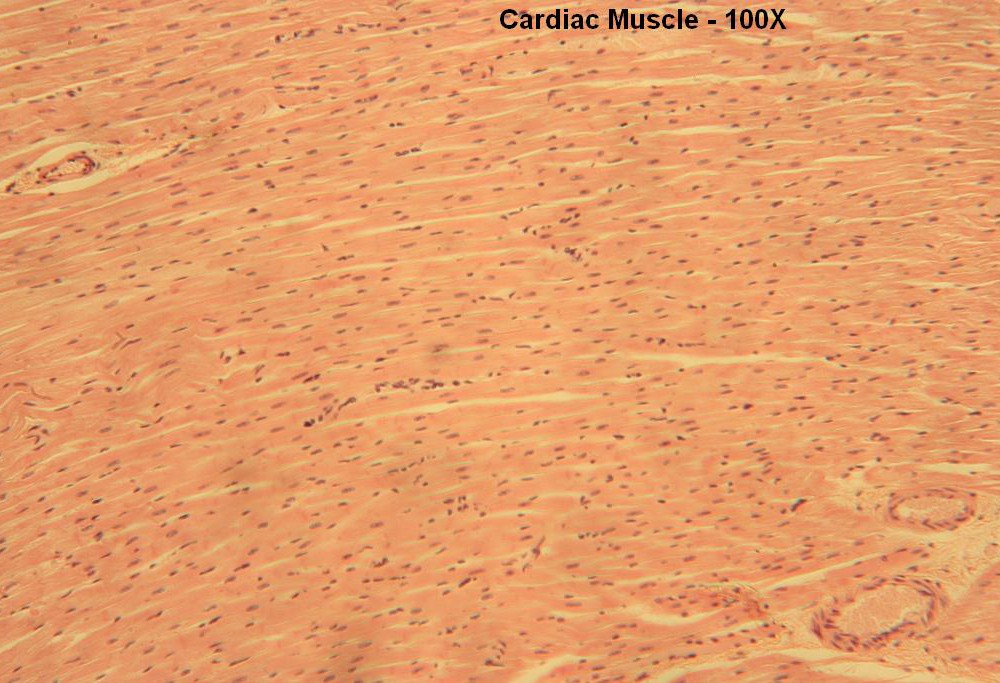 B – Cardiac Muscle 100X 2