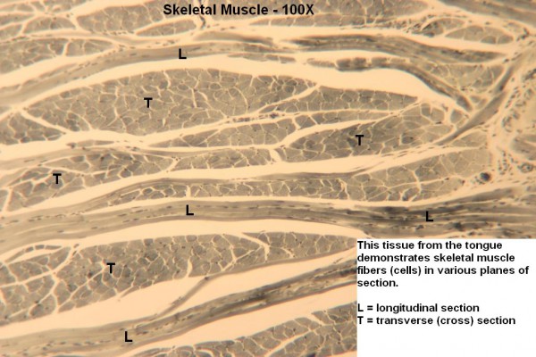 B Skeletal Muscle 100x 2