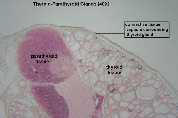 B- Thyroid- Parathyroid 40X 2