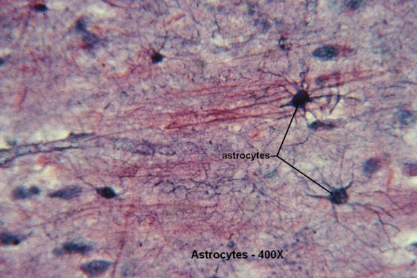 C – Astrocytes 400X 3
