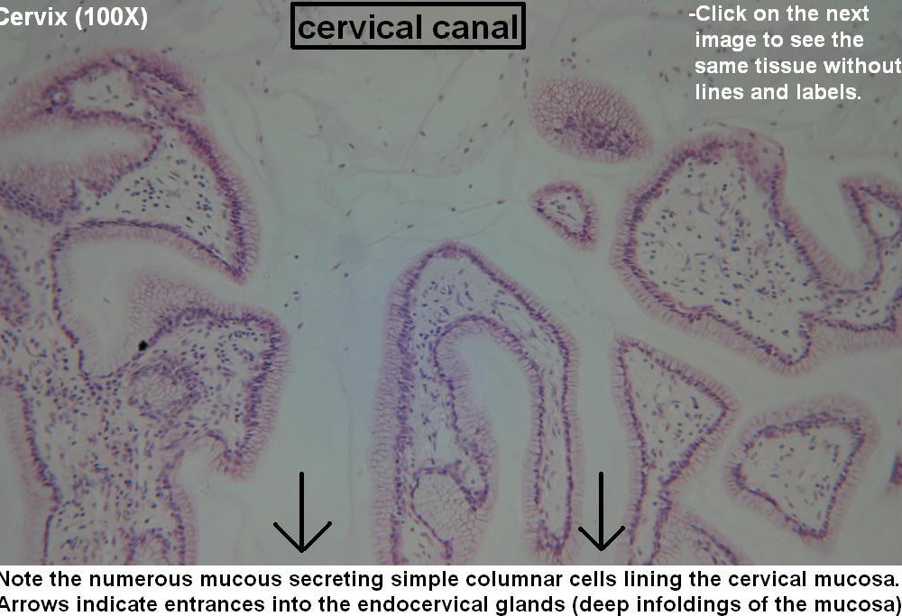 C – Cervix 100X 1