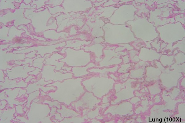 C – Lung Alveoli 100X 3