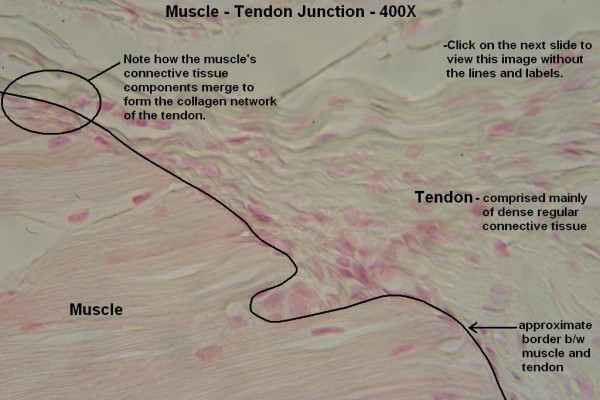 C – Muscle – Tendon Junction 400X 1