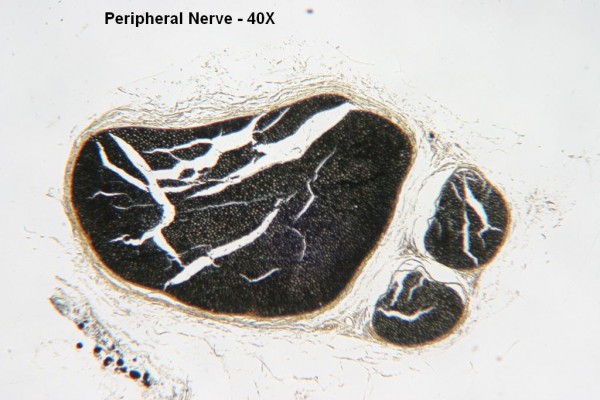 C – Peripheral Nerve 40X 3