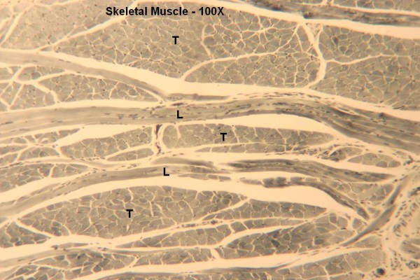 C Skeletal Muscle 100x 3