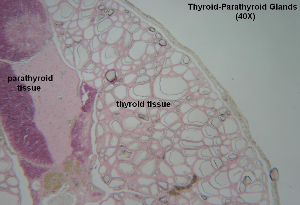 C- Thyroid- Parathyroid 40X 3