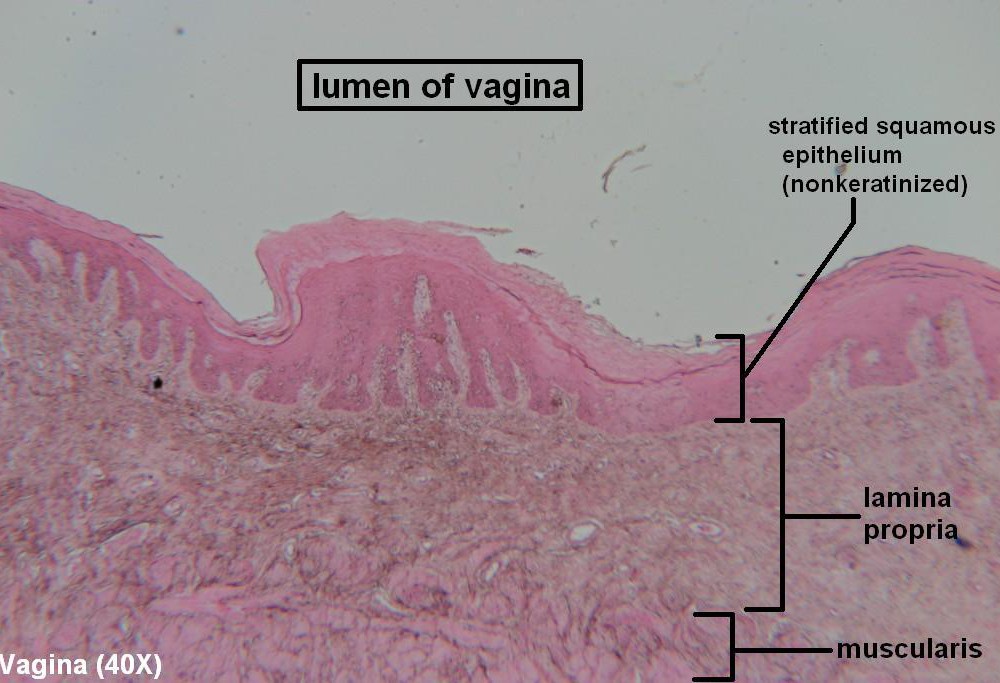 C Vagina 40x 3
