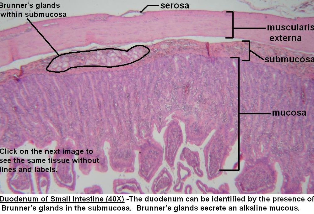 D – Duodenum Wall 40X 1