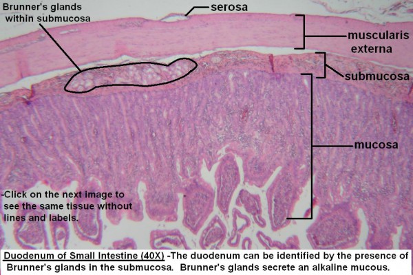 D – Duodenum Wall 40X 1