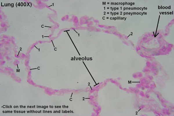 D – Lung Alveoli 400X 1