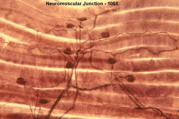 D – Neuromuscular Junction 100X 2