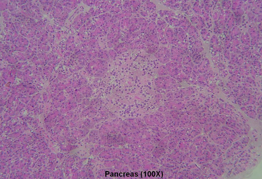 D – Pancreas 100X 2