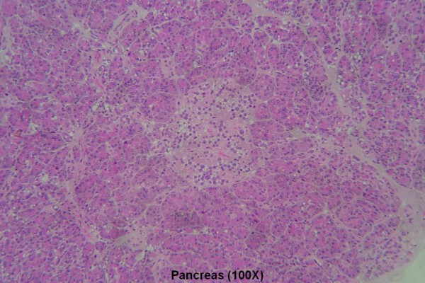 D – Pancreas 100X 2