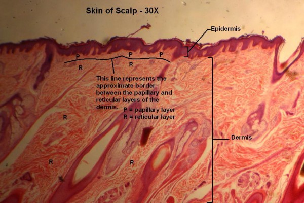 D Scalp 30x 3 Layers of Dermis