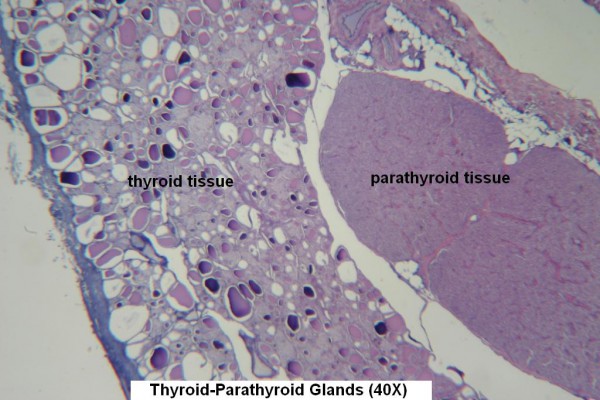 D-Thyroid- Parathyroid 40X  4