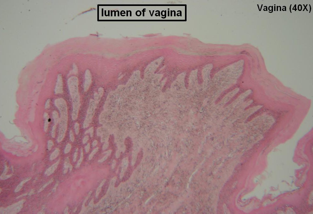 D Vagina 40x 4