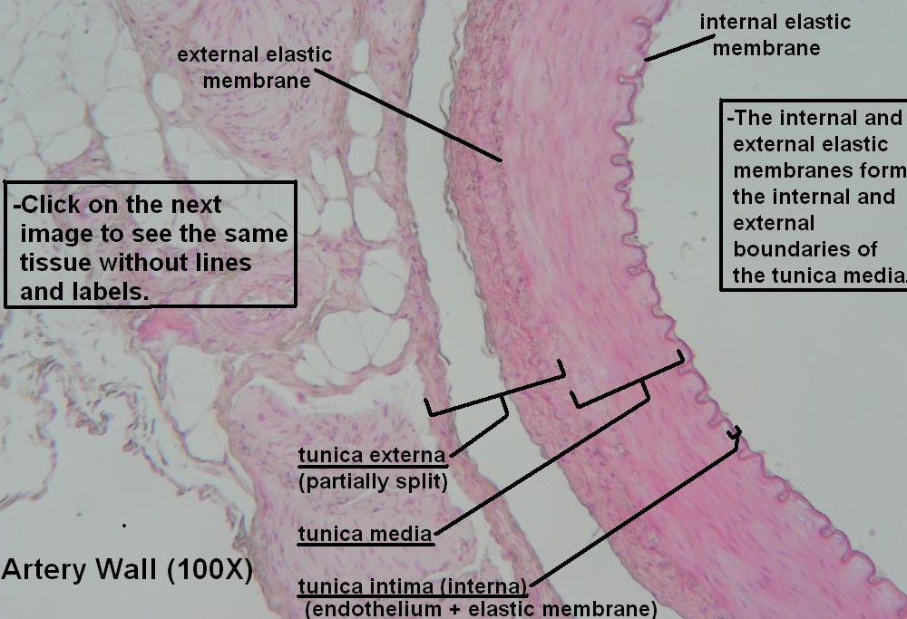 E Artery Wall 100X 1