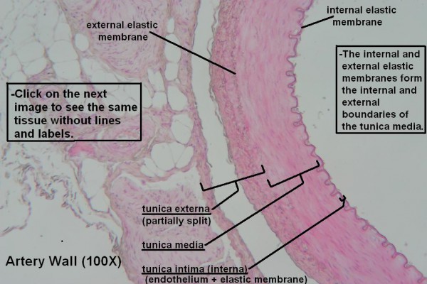 E Artery Wall 100X 1