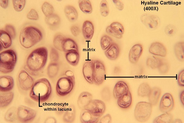 E Hyaline Cartilage 400X
