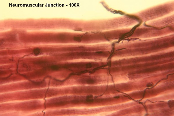 E – Neuromuscular Junction 100X 3