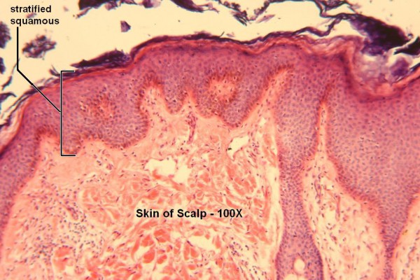 E Stratified Squamous 100x 3